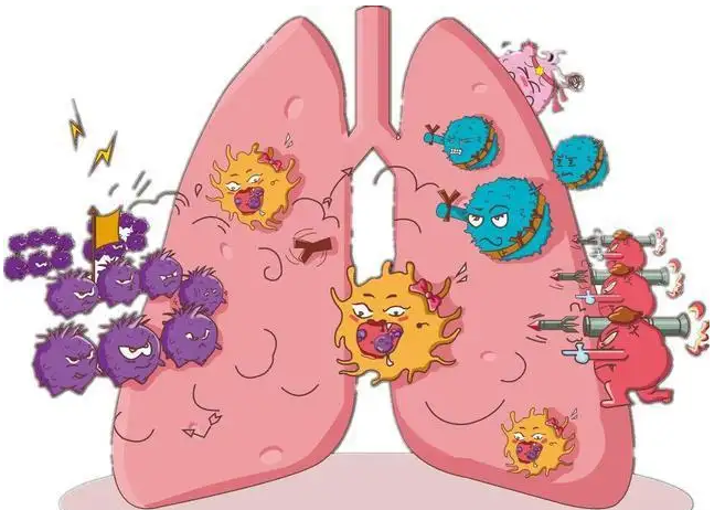 杭州御和堂中医提醒肺癌晚期有什么症状？